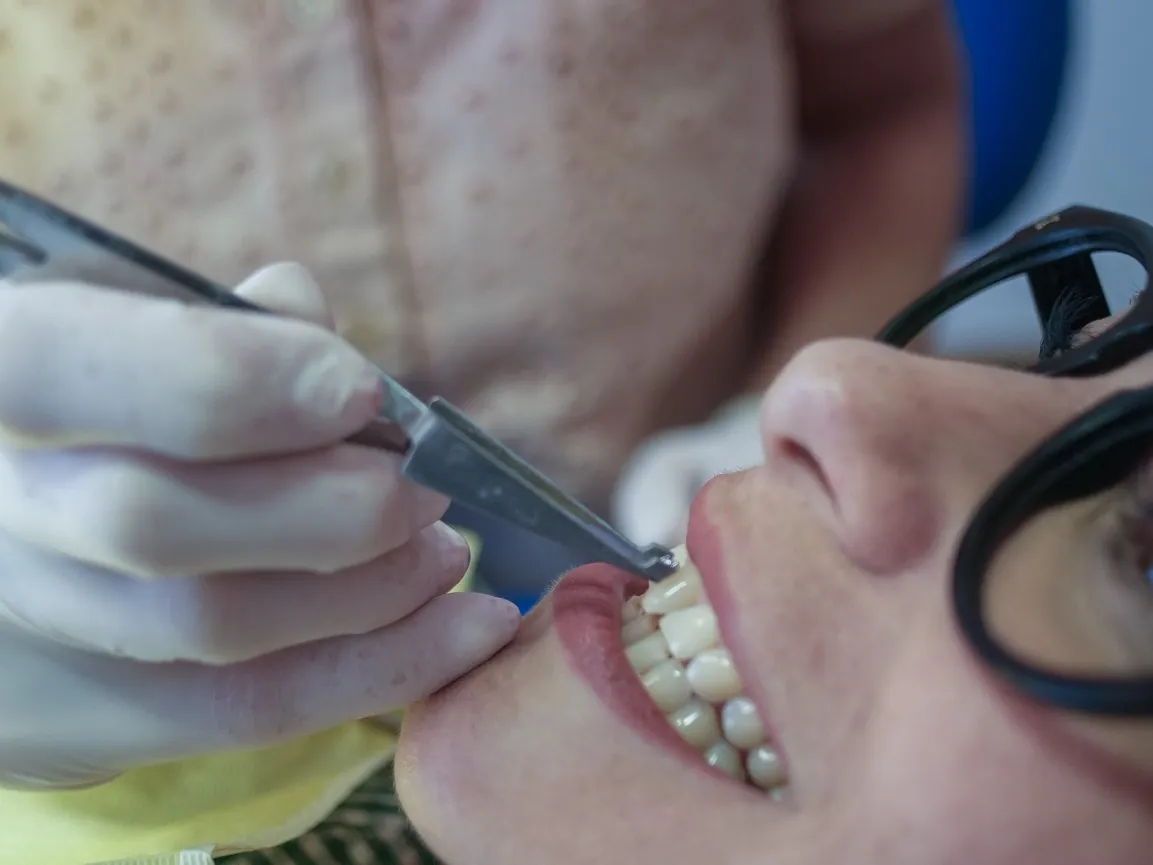 Control de ortodoncia con brackets en OdontoBa